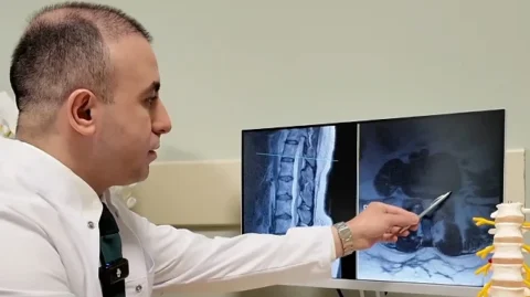 Bel Fıtığı İçin Dikkat Edilmesi Gerekenler ve Ameliyat Alternatifleri